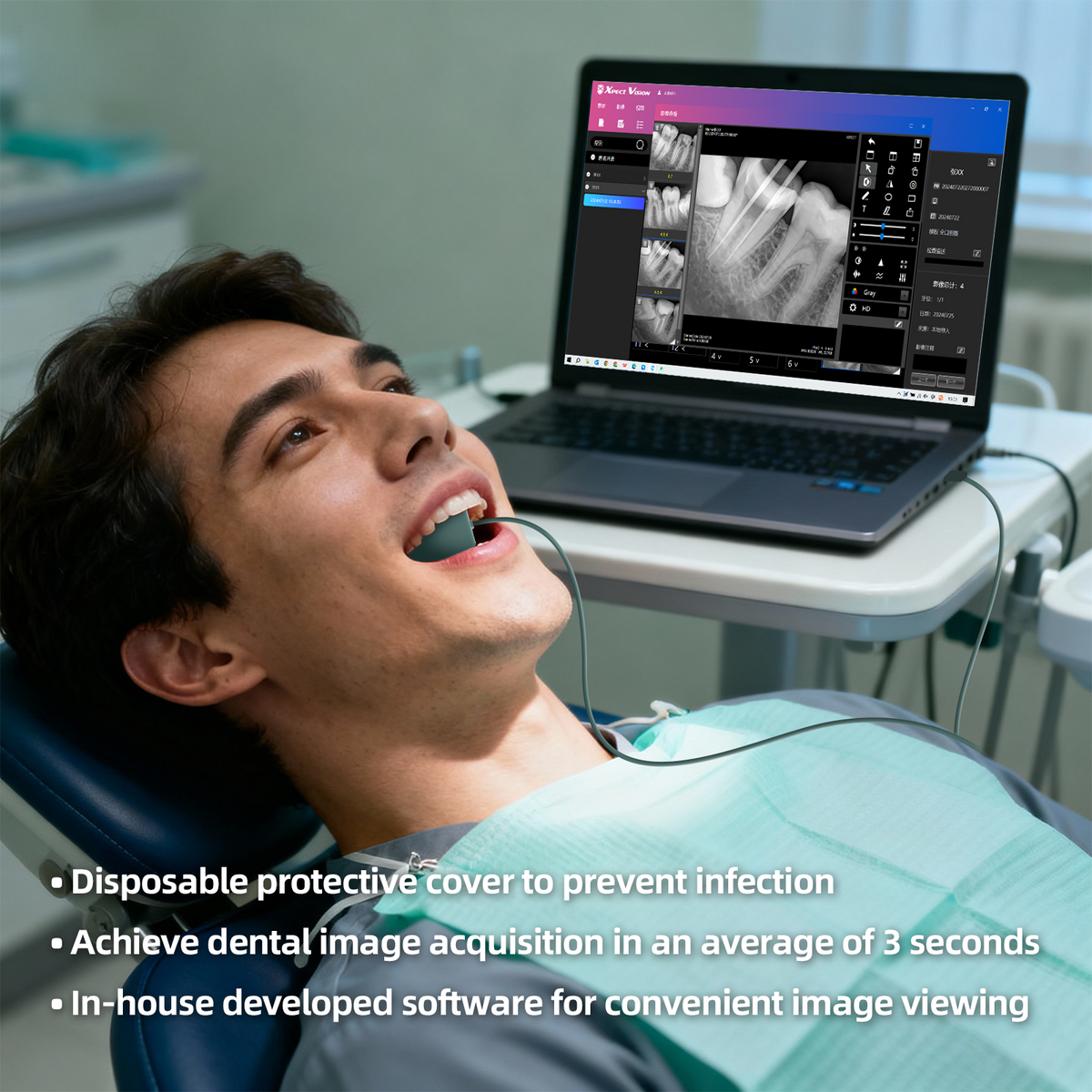 Digital Intraoral Sensor, Portatil Dental Carmera Machine, HD Direct Imaging, with Windows Software, Support TWAIN