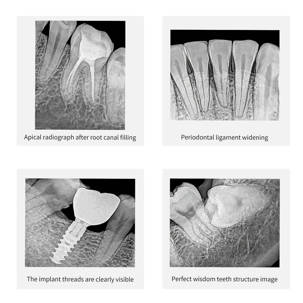 Digital Intraoral Sensor, Portatil Dental Carmera Machine, HD Direct Imaging, with Windows Software, Support TWAIN